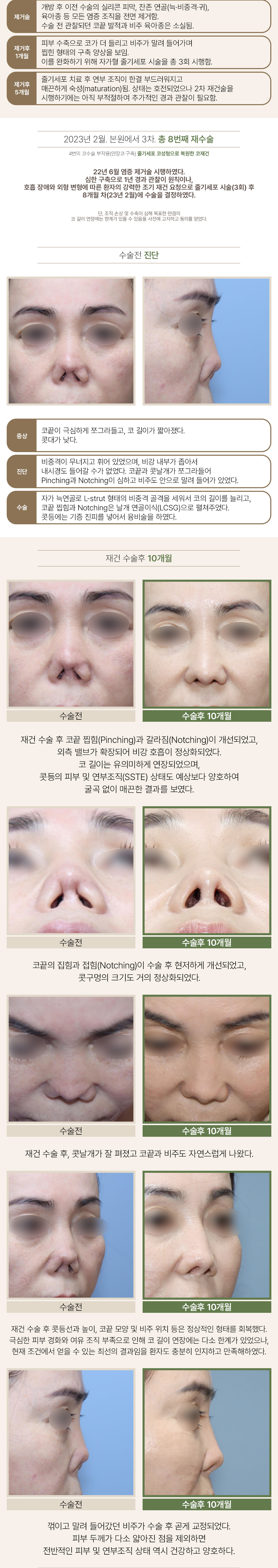 260822_줄기세포코재건_03.jpg