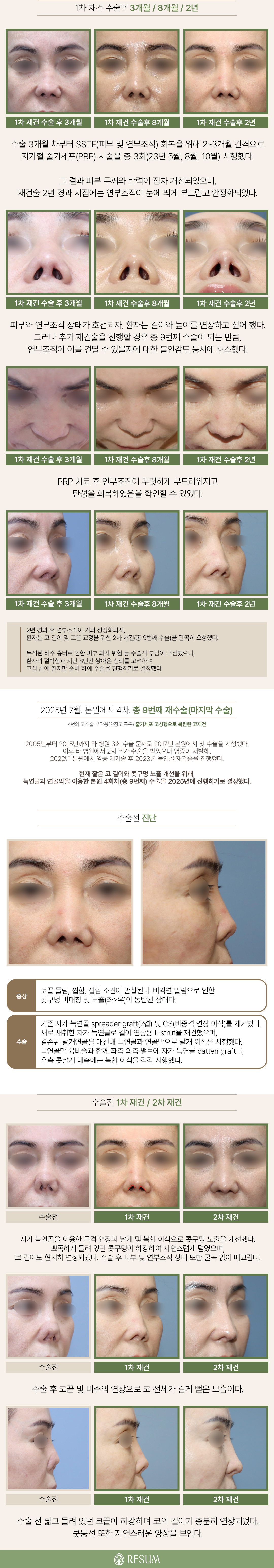 260822_줄기세포코재건_04.jpg