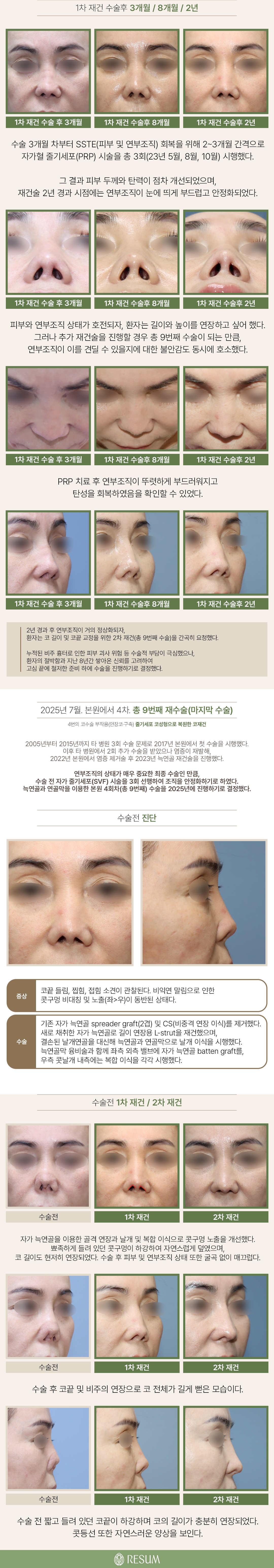 260822_줄기세포코재건_04.jpg