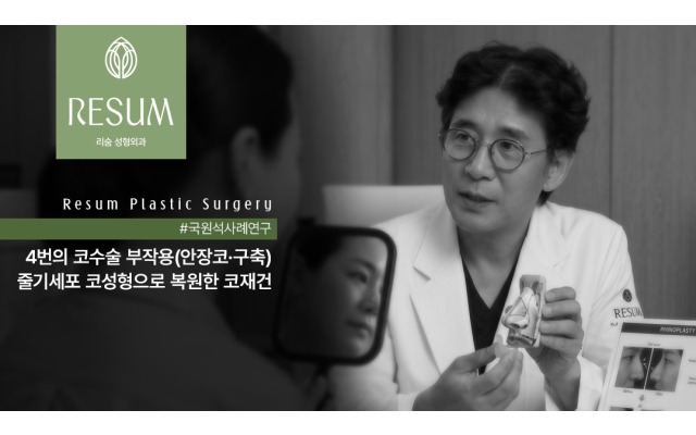 4번의 코수술 부작용(안장코·구축)을 줄기세포 코성형으로 복원한 코재건 사례 썸네일