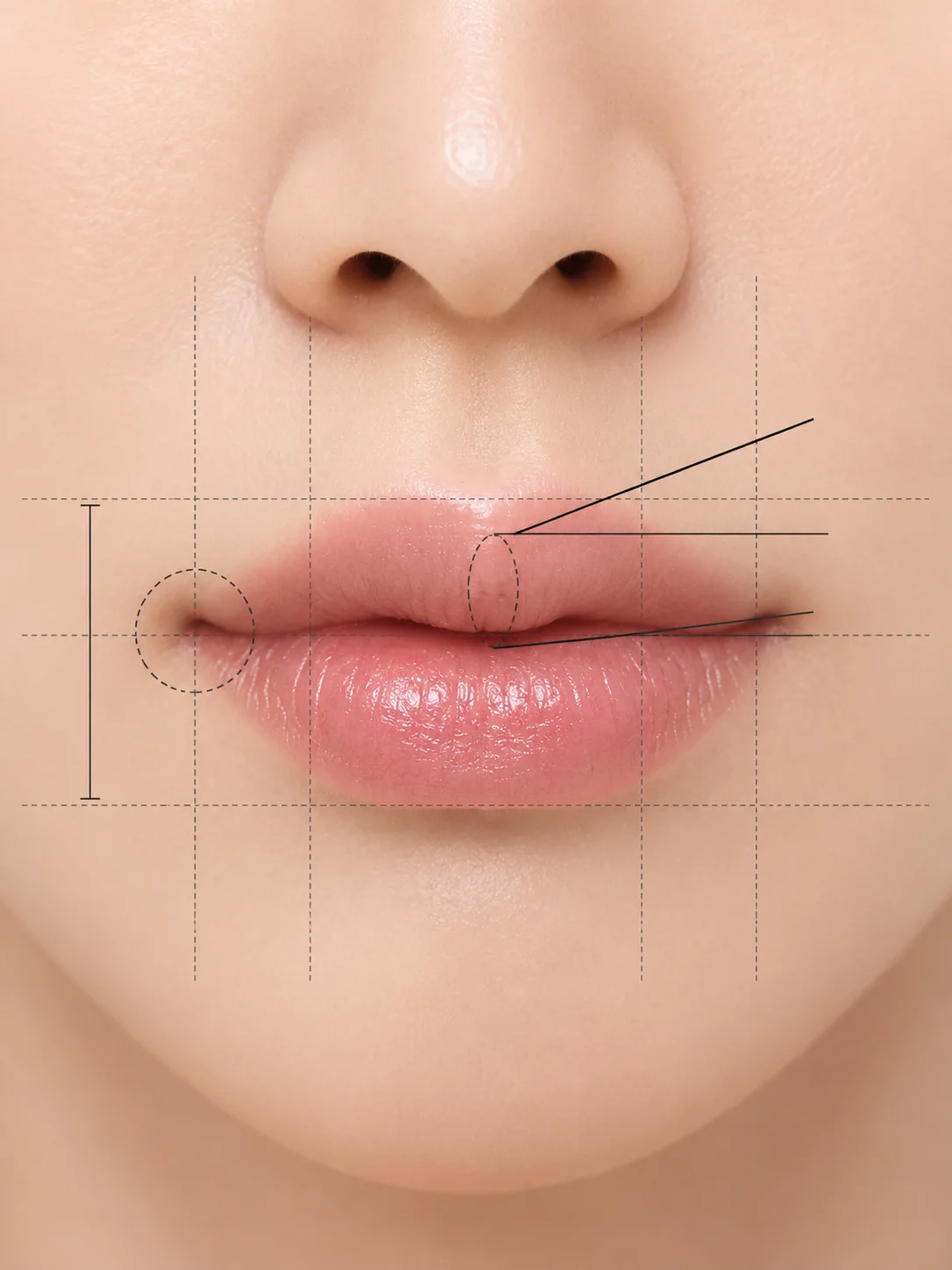 가로확장 입술필러 디자인