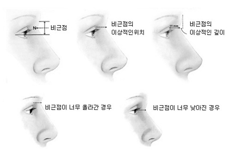 이상적인 코 모양은 무엇으로 결정될까? 설명 이미지