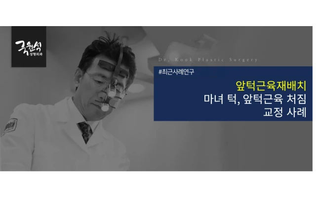 앞턱근육재배치 - 마녀턱, 앞턱근육 처짐 교정 사례