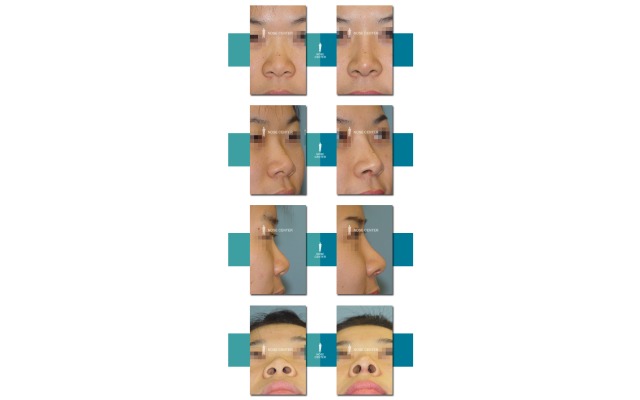 코