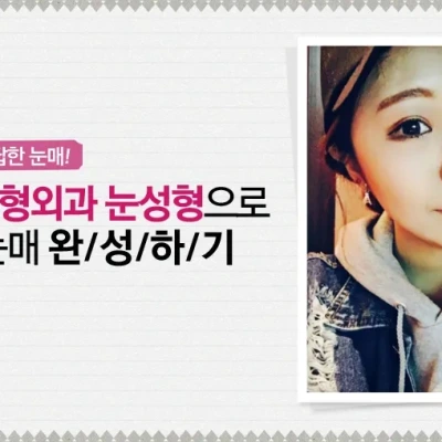 여기서 눈성형 하길 잘했어요!!!