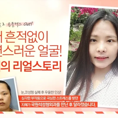 눈,코재수술로 콤플렉스 OUT!!!!