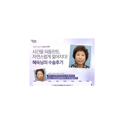 얼굴당김술(이마당김술) 후기 입니다~