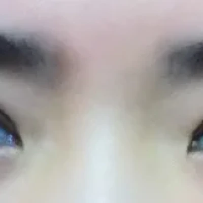    완전절개16일후기입니다^-^ (2차 후기)