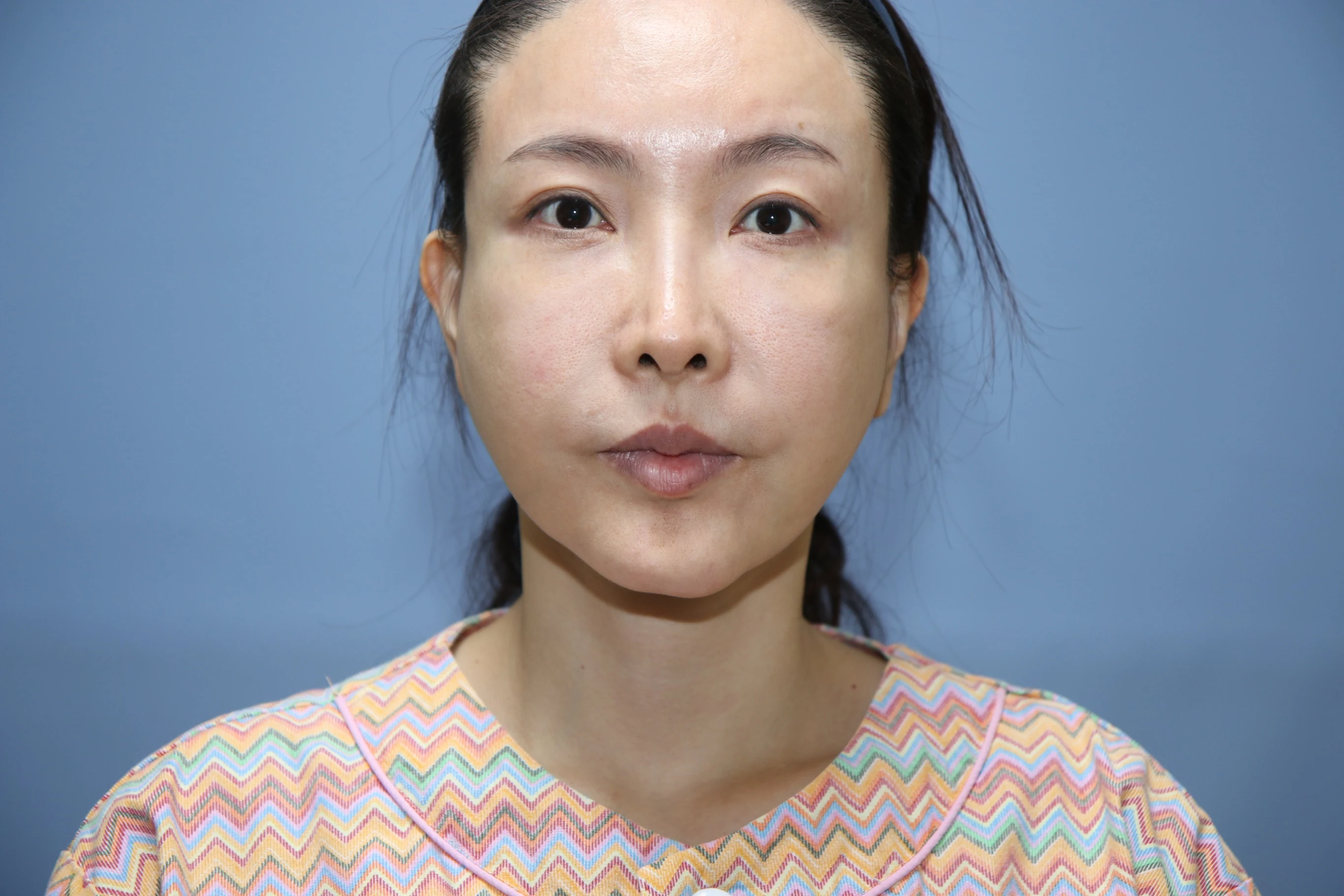 02. 입술이 아래로 떨어짐