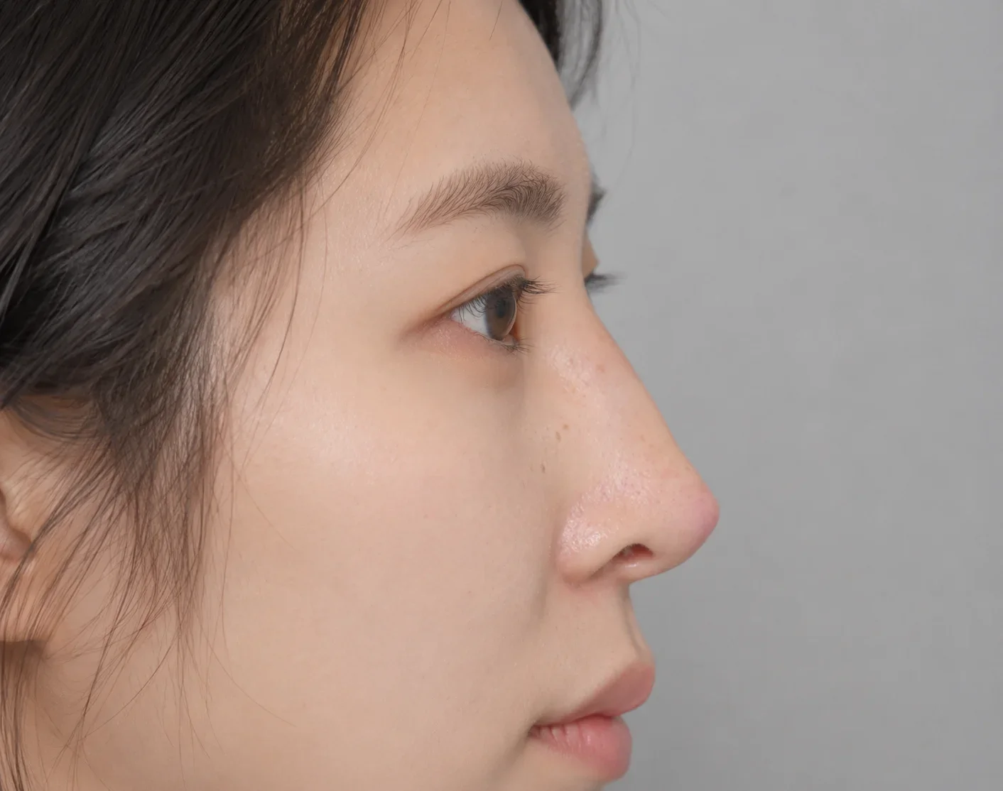 부적절한 보형물의 모양과 위치