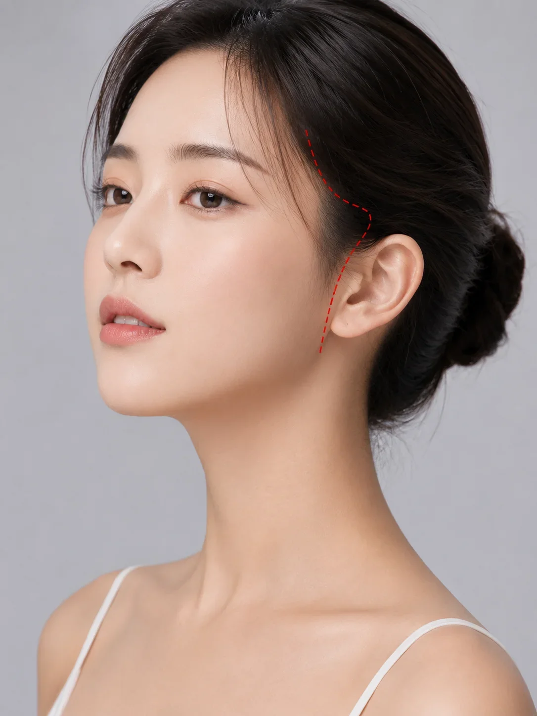 짧은 절개 SUTURE 안내 이미지