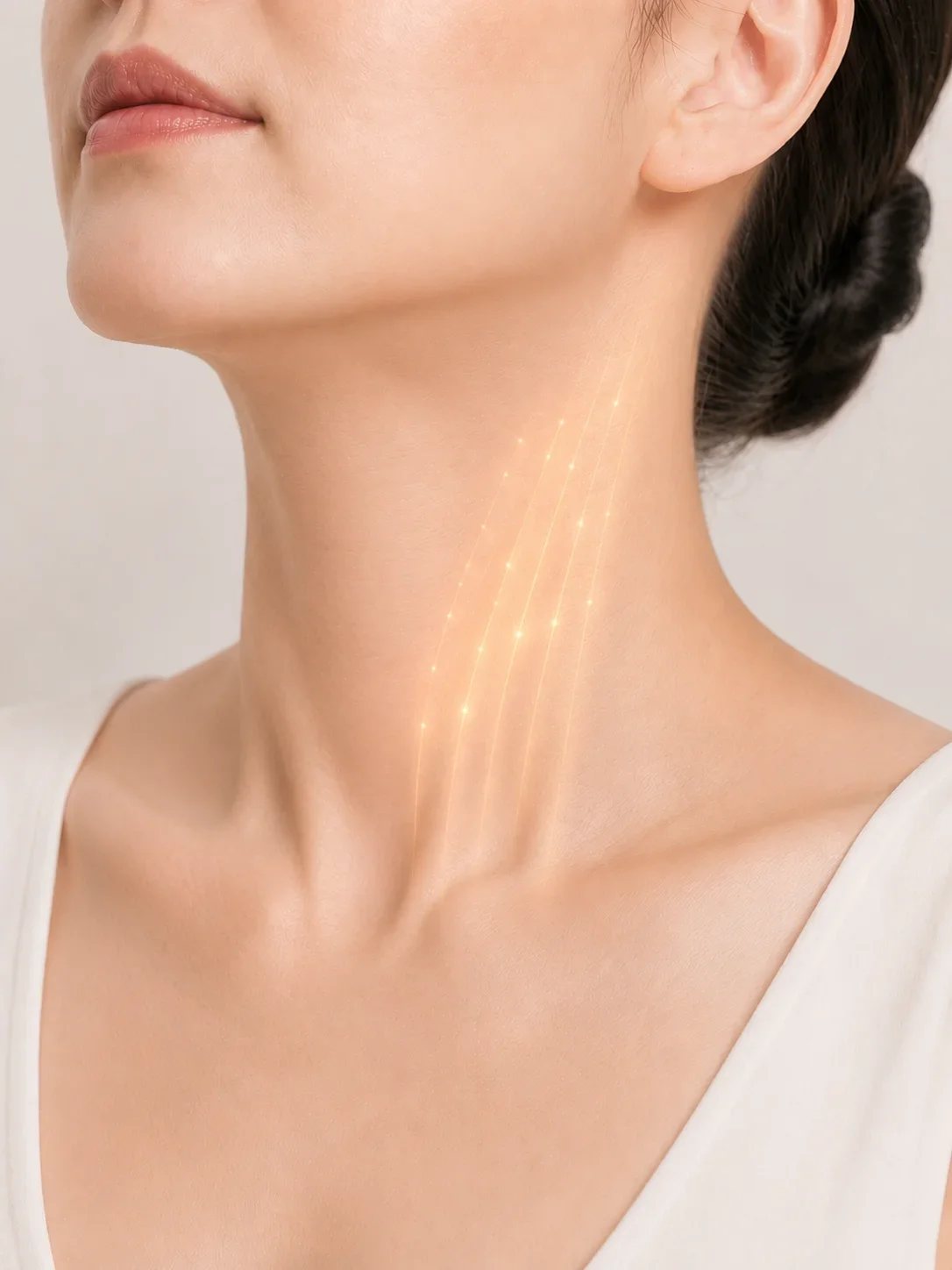 광경근 단위 측면 접근 INCISION 안내 이미지