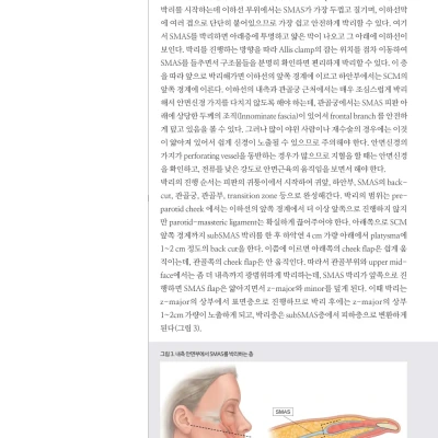  [메디컬S] 2015년 12월호 : 안면거상술 High SMAS Face Lift(2) 