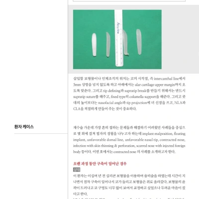 [메디컬S] 2016년 2월호 : 코재수술 상태 분류 및 case별 치료 내용