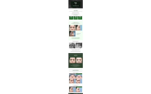 Contracted Nose Revision Surgery Case