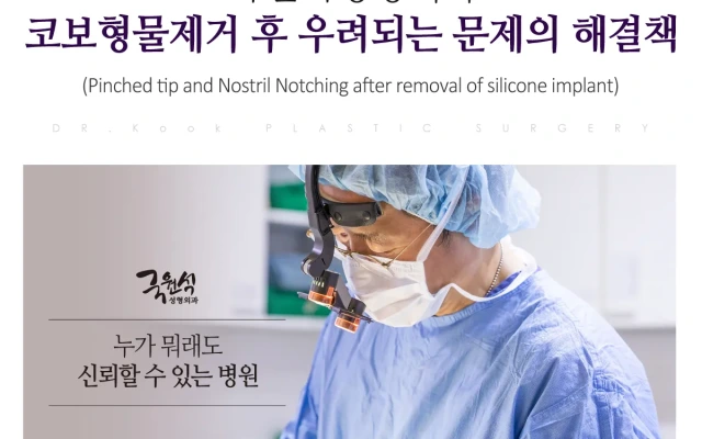 Pinched Nasal Tip and Nostril Retraction (Pinching & Notching) 04