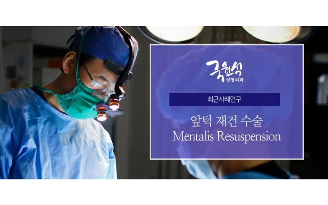 あご先の再建手術(Mentalis Resuspension)
