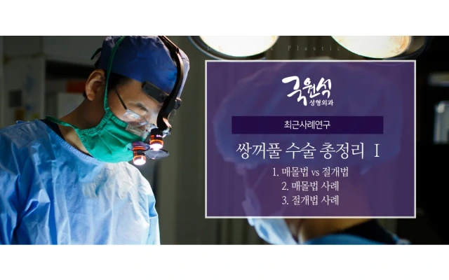 쌍꺼풀수술 총정리 1편 (매몰법과 절개법/사례)