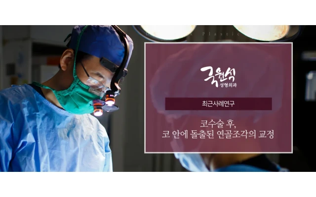 코수술 후 코 안에 돌출된 연골조각의 교정 #비주연골튀어나옴