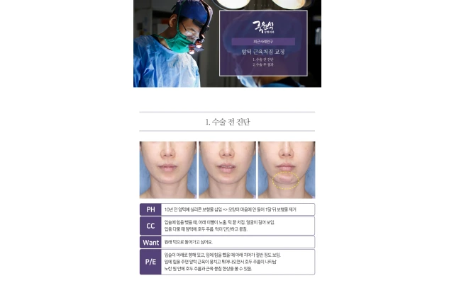 앞턱근육처짐교정 ptotic chin / chin ptosis / witch’s chin 
