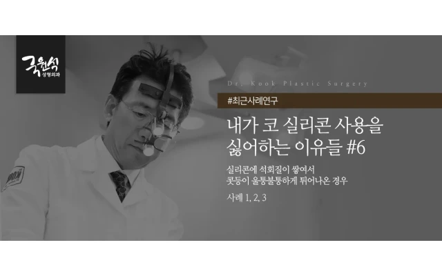 내가 코실리콘 사용을 싫어하는 이유 #6 (코성형부작용/코실리콘제거/코보형물제거)