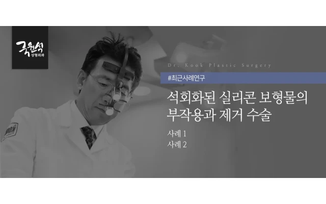 석화화된 코실리콘 보형물 부작용과 제거수술 (코보형물제거수술 / 코재수술)