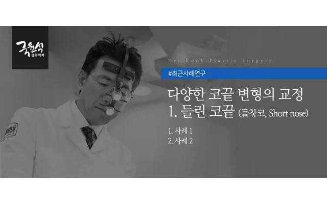 다양한 코끝 변형의 교정 #1 들린 코끝 (들창코, Short nose)