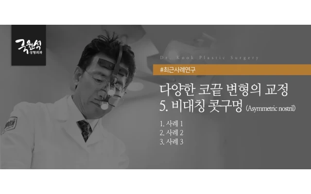 다양한 코끝 변형의 교정 #5 비대칭 콧구멍(코재수술)