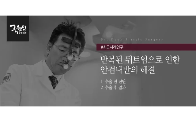 반복된 뒤트임으로 인한 안검내반의 해결