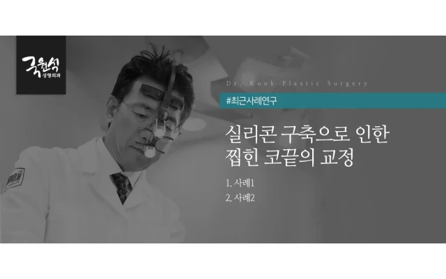 실리콘 구축으로 인한  찝힌 코끝의 교정 (구축코교정/코보형물제거)
