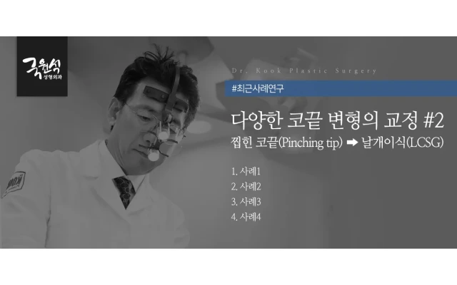 다양한 코끝 변형의 교정 #2 찝힌 코끝(Pinching tip)>날개이식(LCSG)