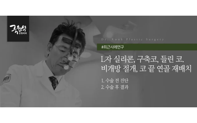 [코재수술 사례 연구]L자 실리콘, 구축코, 들린코, 비개방절개, 코끝연골재배치