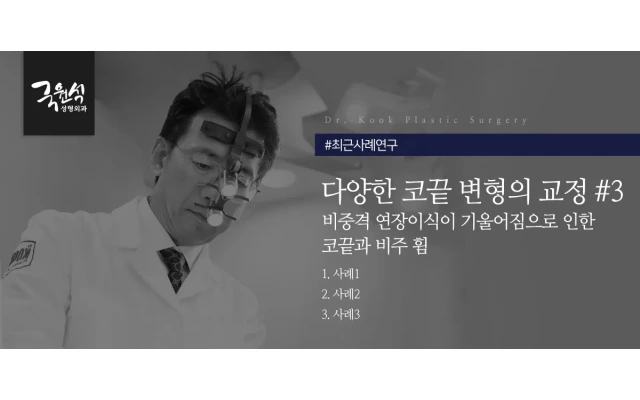 다양한 코끝 변형의 교정 #3 비중격 연장이식이 기울어짐으로 인한 코끝과 비주휨