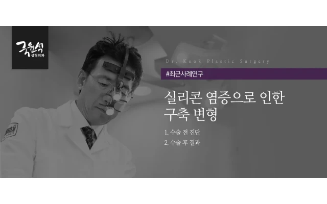 실리콘 염증으로 인한 구축 변형 #구축코 #코보형물제거 #코실리콘 #코보형물염증