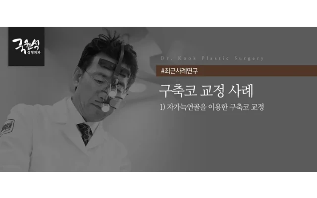 코 수술 부작용 자가늑연골을 이용한 '구축코' 교정 사례