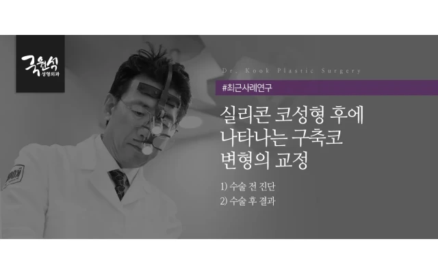 실리콘 코성형 후에 나타나는 구축코 변형의 교정 #구축코 #코재수술 #코보형물제거 #들창코
