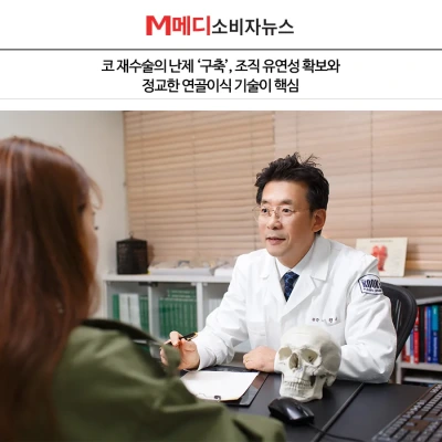[M메디소비자뉴스] 코 재수술의 난제 ‘구축’, 조직 유연성 확보와 정교한 연골이식 기술이
